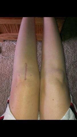 ACLcantstopme's profile picture. Right when I thought it was the end, God said, No my child, this is just the beginning. Keep going. Everything happens for a reason!