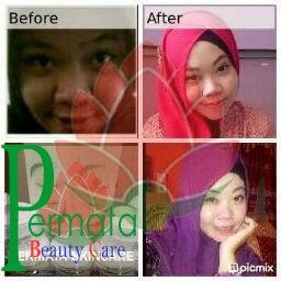 Berbagai Produk Perawatan Kecantikan Racikan Dokter Farmasi BPOM by THERASKIN & IMMORTAL | Follback Just Mention | CS : 25BEF512 ✉08995410325 | Testi cek Fav |