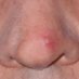Guy's Zit (@guyszit) Twitter profile photo