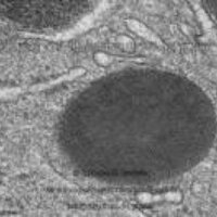 Lysosome (@17lyfosome) 's Twitter Profile