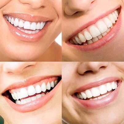 We're a friendly and full service dental office specializing in implants and cosmetic restorations.