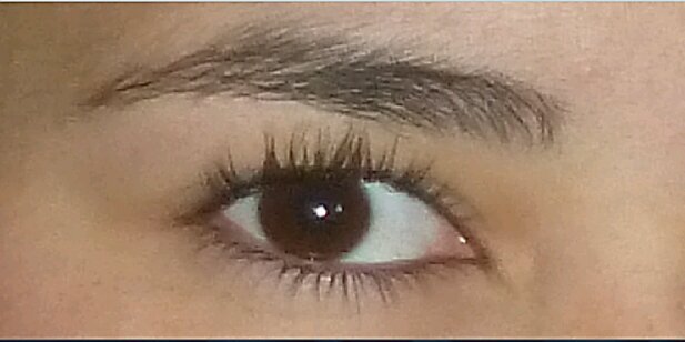 Ojo por ojo... diente por diente