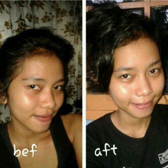 Health Consultant | PIN:28F82F79 | 083896469358 | Ingin putih, tinggi, langsing, mata minus tuntas dalam 2 minggu ? Add aja :D