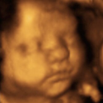 ImageOfAMiracle's profile picture. 4D Ultrasound Center in Columbus, GA - An Experience Of A Lifetime! - Gender Determination, CD, DVD, Color Photos, Listen to your baby's heartbeat!