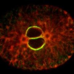 Laboratory of organelle biogenesis and homeostasis - studying ER organization and size control; discovering roles for the nuclear envelope lipid environment