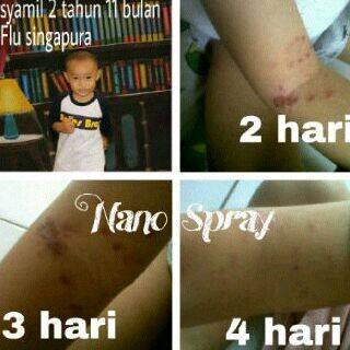 NANO SPRAY web qu : http://t.co/Fw6yEHvomD oriflame,BV,VSI silakan add pin 26B69EB5, 08978175972 RIKA for serius ODER,and for fashion OL SHOP,NO TIPU THX