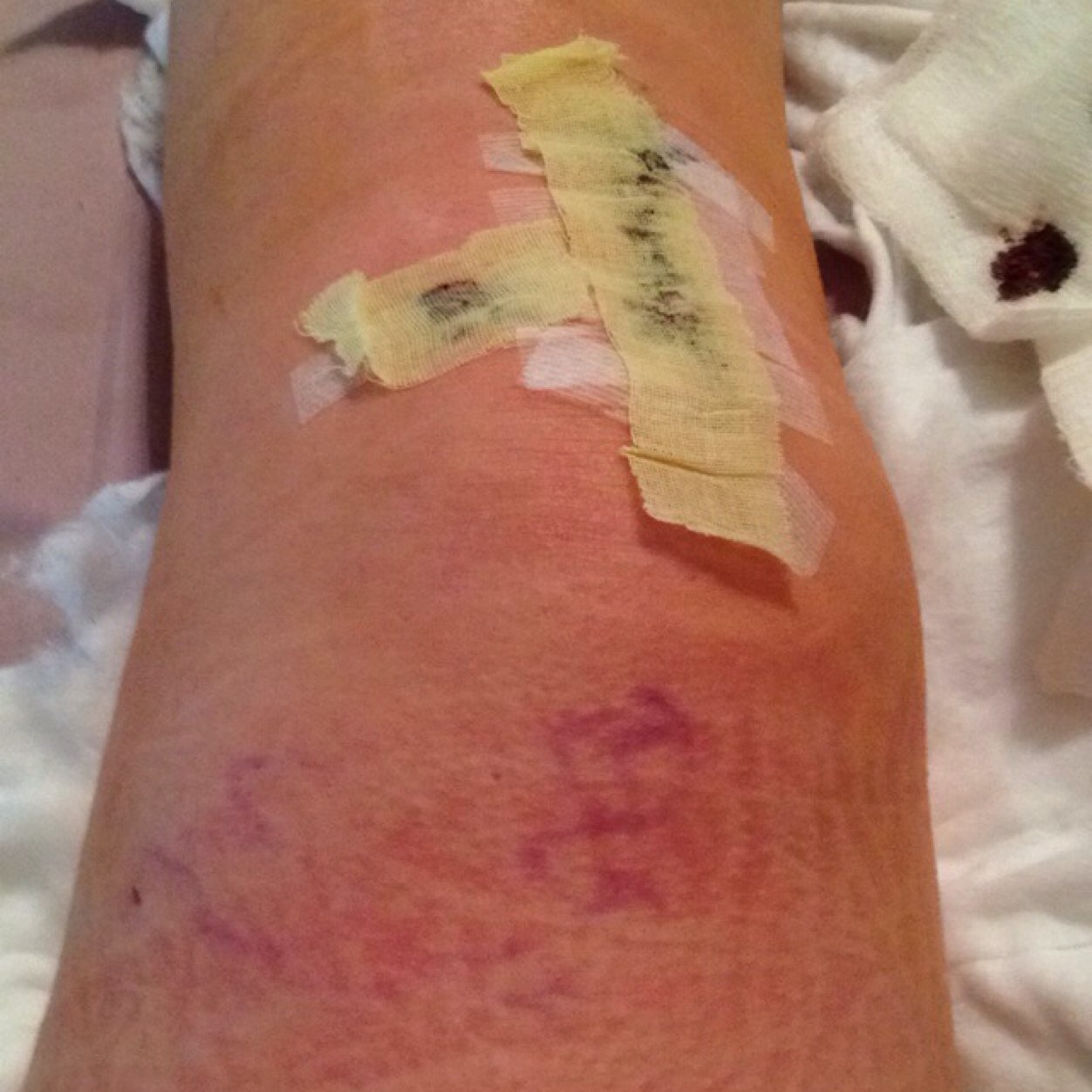 thefitconquer's profile picture. I've torn my ACL, meniscus, and injured my MCL ⚽️. I recently began my rode to recovery. This account is to tell my story. - This is survival of the fittest.