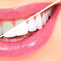 dentalantonioza's profile picture. Si quieres conocer nuestras ofertas y promociones, síguenos.               CLÍNICA DENTAL DRA.LAURA ANTONIO ZANCAJO