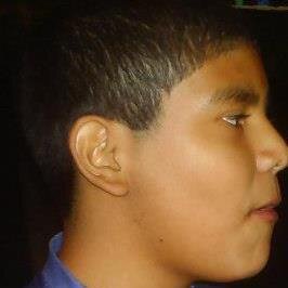 niño de 18 años