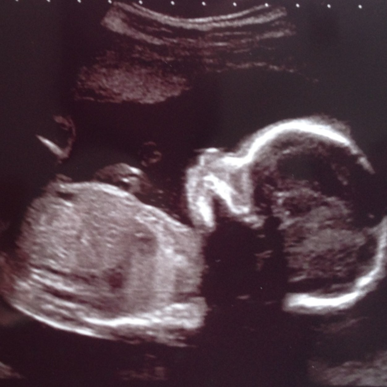 Pregnancyhour's profile picture. Hosted by @Bump2Tot2014 every Tuesday 8-9pm for all things pregnancy related. Just add #pregnancyhour to your tweets.