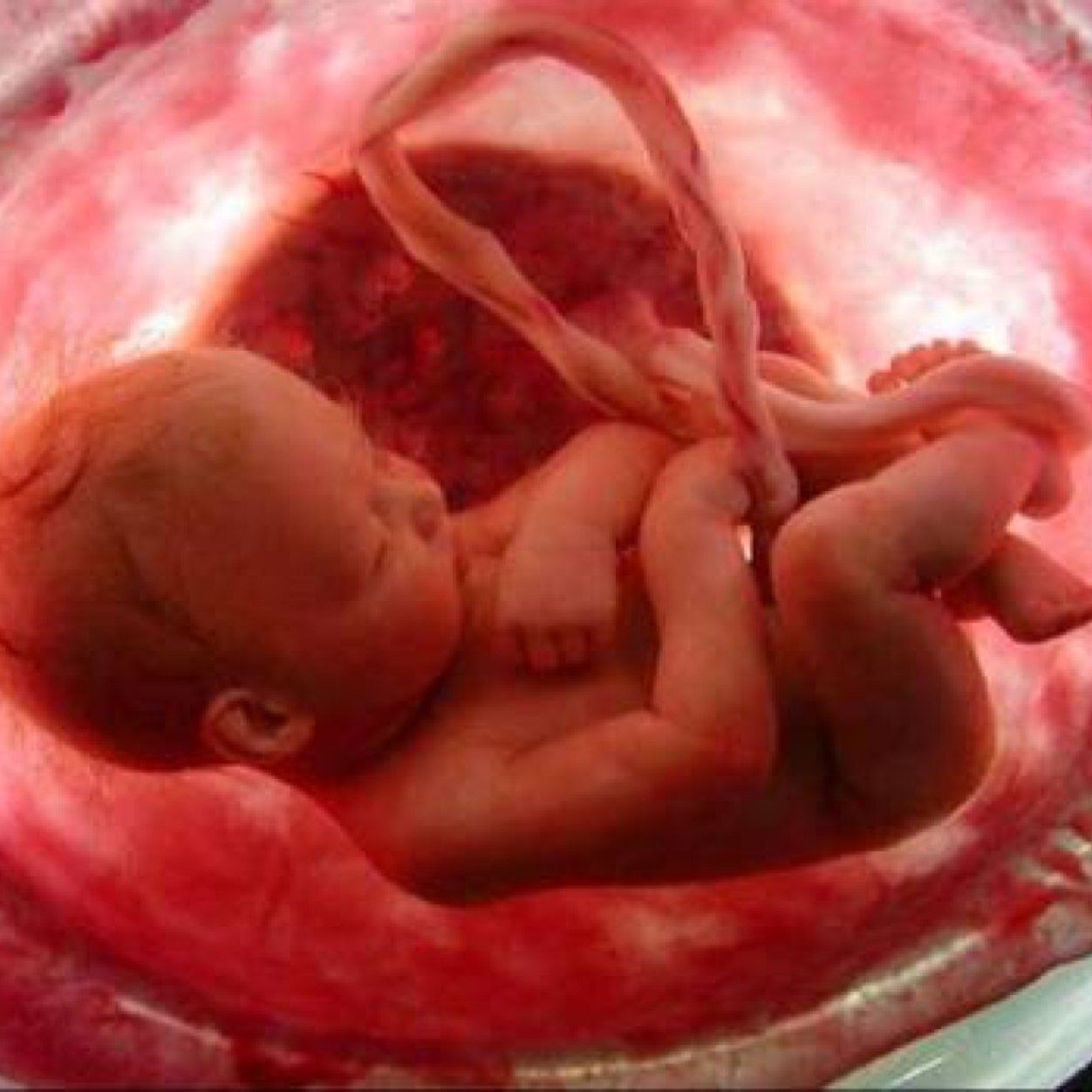 Medicina fetal y Ginecología Endoscópica.