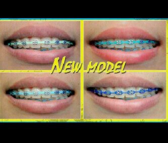 Open order yuk :* behel pasang lepas 90.000 free ongkir. Permanen 145.000. Garskin 30.000 kulit jeruk♥||pin : 2B29EA3D