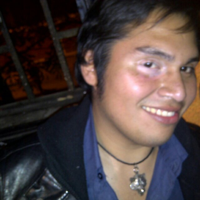 Misántropo, humanista, nihilista, megalómano, narcisista, sociópata pseudo ecologista, Institutano, mapuche(...) Y humano, aunque me dicen Lobo.