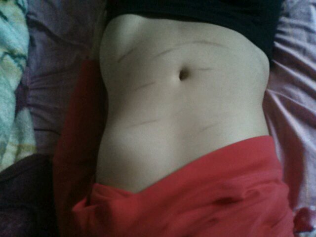 sinisterkxd's profile picture. 5'8 LW: 135 HW: 185 GW1:159(REACHED) GW2:155 GW3:149 GW4:140 UGW:115