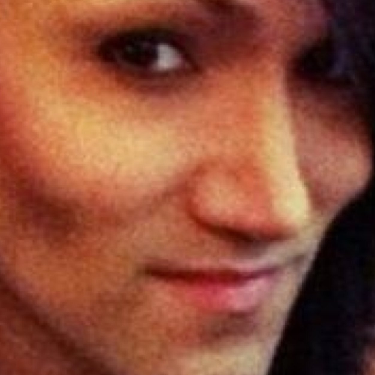 We are those gravity defying things on Ashley Purdy's face. Were like boners we are rasied high when were happy!!!!