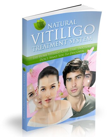 Helping You Banish Your Vitiligo For Good - Vitiligo Cure Information