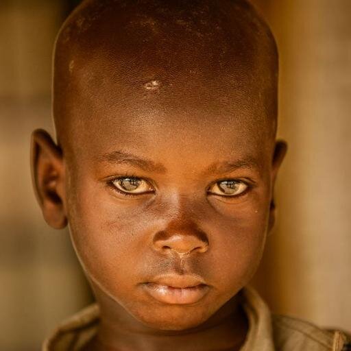 Al Norte de Kenia, a orillas del lago Turkana, encontramos una de las zonas más pobres del planeta. ¿Nos ayudas? #CirugiaTurkana #helpTurkana