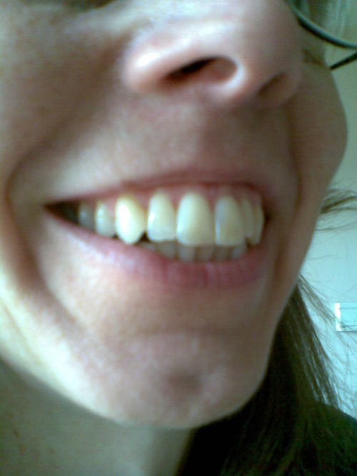 DentalDiscounts's profile picture. Saving you money with low priced dental products.