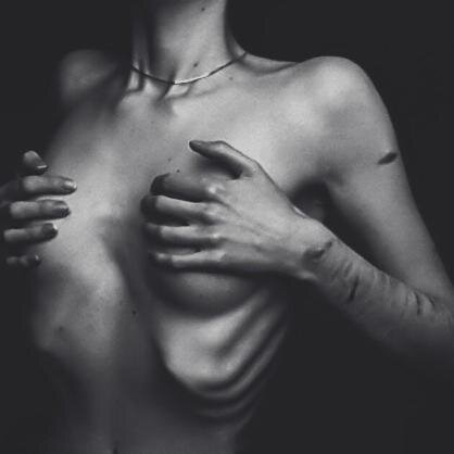 depression | anorexia | anxiety | OCD. 22 y.o.