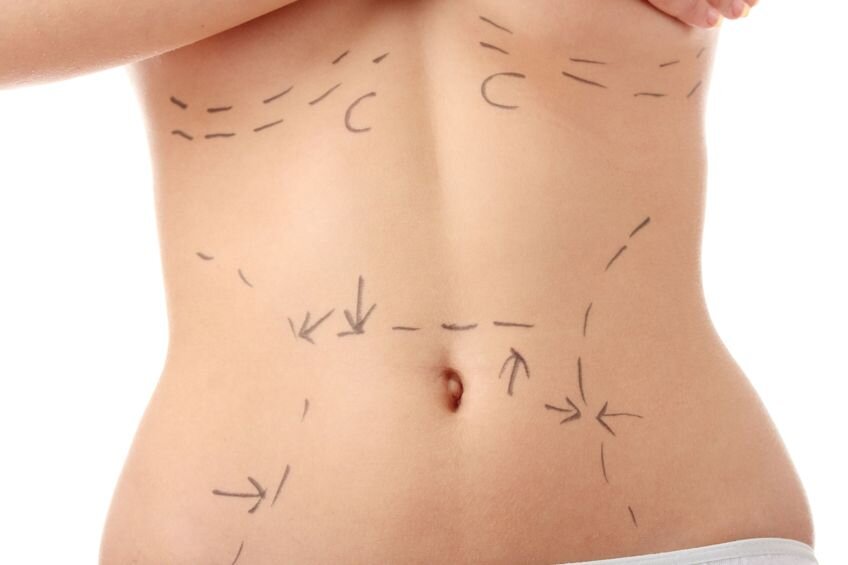 Find Tummy Tuck Surgeons Near You! Find the best abdominoplasty surgeon for your tummy tuck operation in your local area.