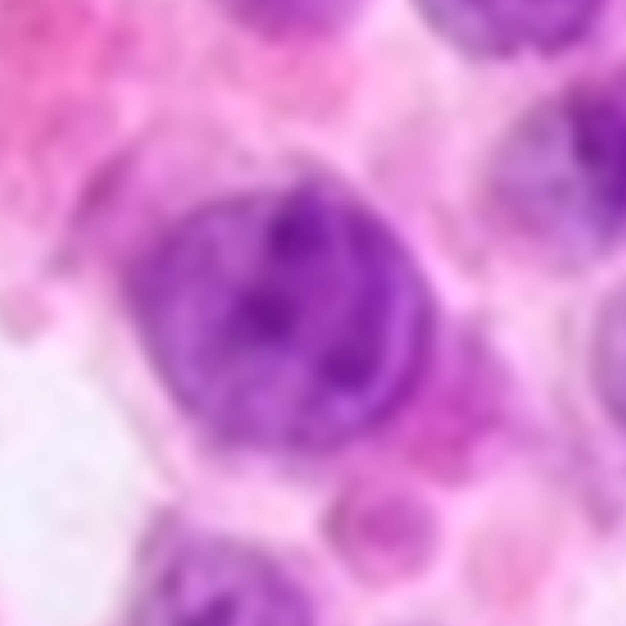 Pathologically eponymous