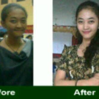 Mau pemutih badan, peninggi badan, pelangsing badan, penggemuk badan, jerawat (hilangkan flek hitam & bekas-bekas), mata minus, dll hub; 327A33A4 / 081281104127