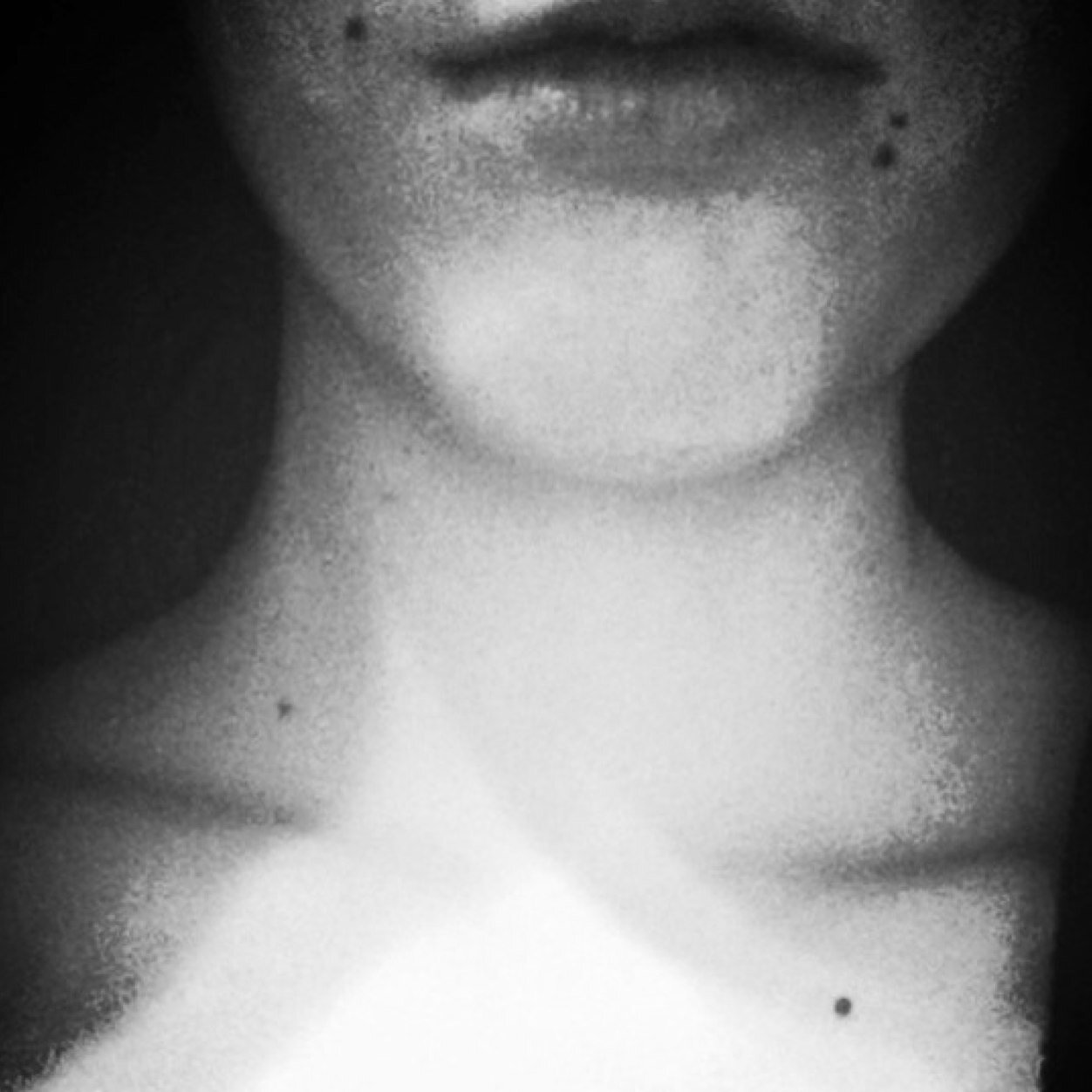 Trying to stay alive. But also trying to die
| CW:fat | GW:100 |UGW:90 insta - getmeoutalice