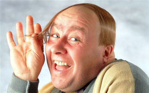 Yeah baldy, and proud, bring on the cigars