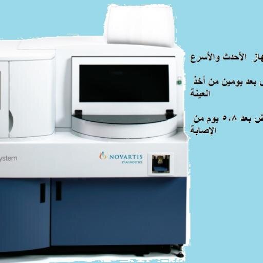 مخيبرات دلتا  أحدث الأجهزة و النظم الطبية السريعة  لفحوصات الأيدز