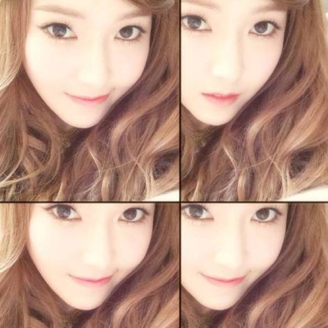 taeyeon double eyelid surgery