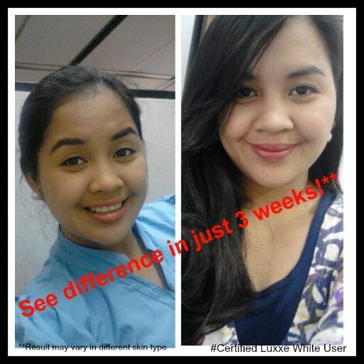 For orders contact me at
SMS 09258022213/09088816521
FB Acct. tine_dino@yahoo.com