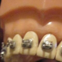 orthocourse's profile picture. Labial 2 Lingual Comprehensive Handson Orthodontic Courses