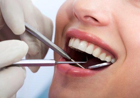 Teeth Whitening Dentist White Home Teeth Whitening