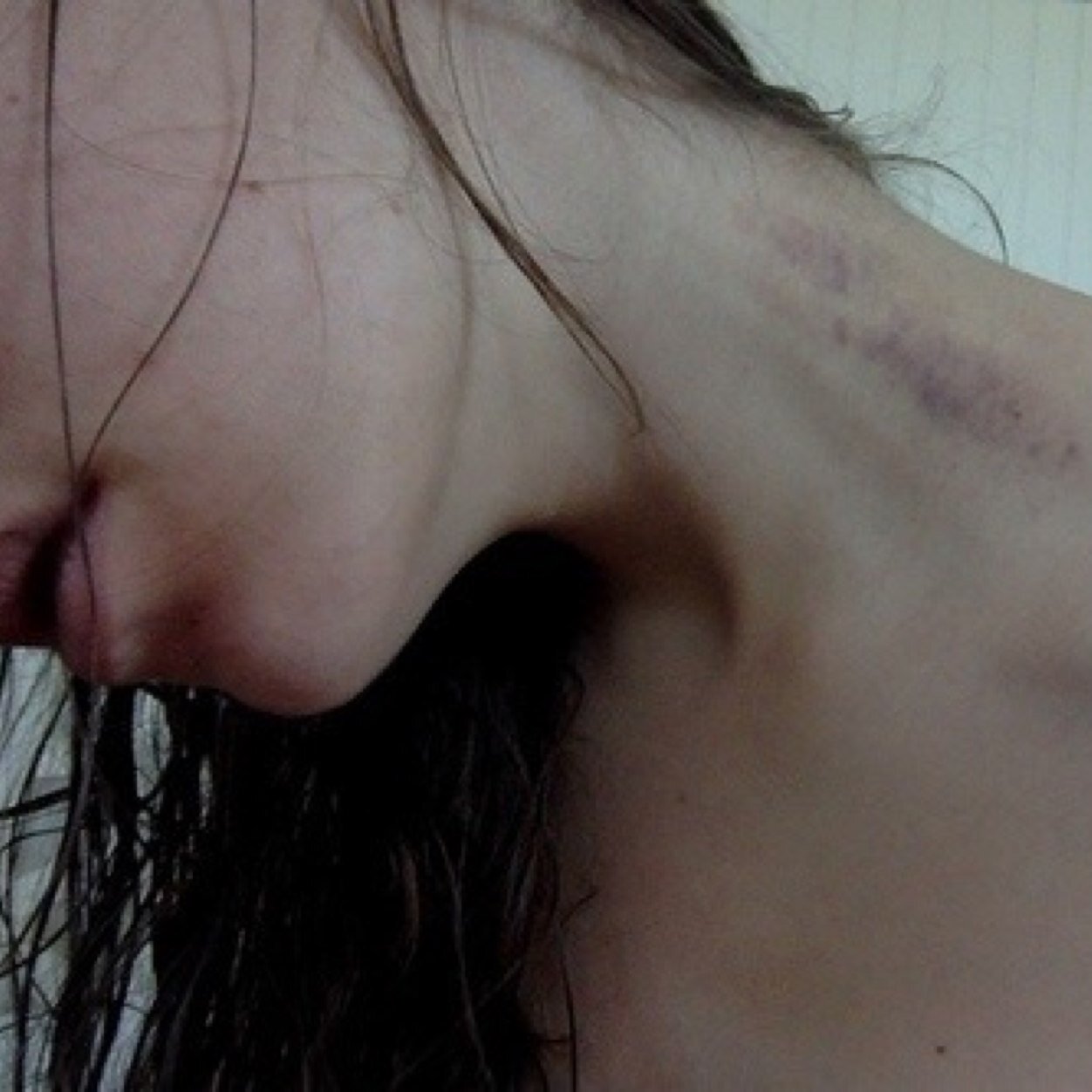 I find beauty in bruises & poetry