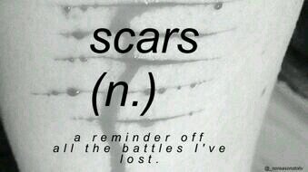 LivingLively123's profile picture. 20, deaf, suicidal, self harm, depression, anxiety.