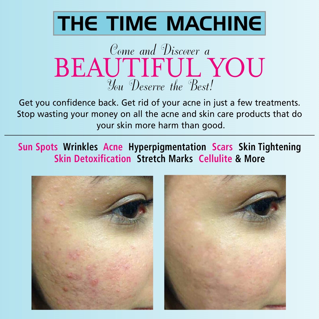http://t.co/ICBkWNWD7u The Time Machine Program was designed to strip years of the aging of the way you look.