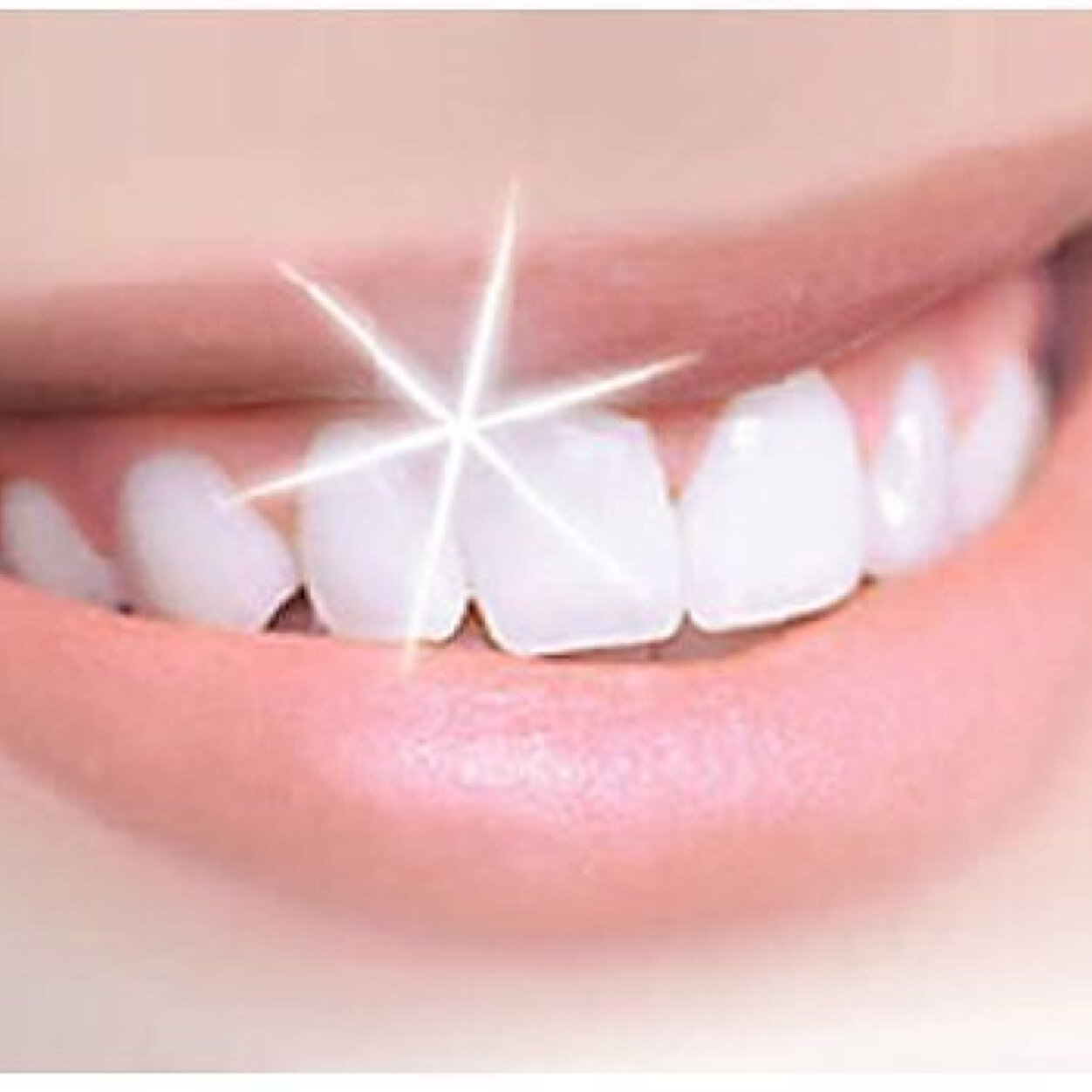 Mobile Teeth Whitening, fully trained by Lovelite in Harley Street.