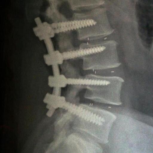 TGFrankenspine's profile picture. Gamer. GEEK. Parent. Joker. Disabled. Fluent in Sarcasm. XBox: TechDevilNY 
Member of Overly Mediocre Gamers (OMG) 
#Battlefield #Zombies #Pizza #DenverBroncos