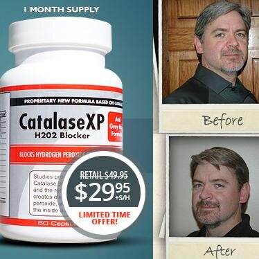 NoGrayHairsXP's profile picture. Catalase XP™ is specifically formulated to prevent and reverse gray hair.