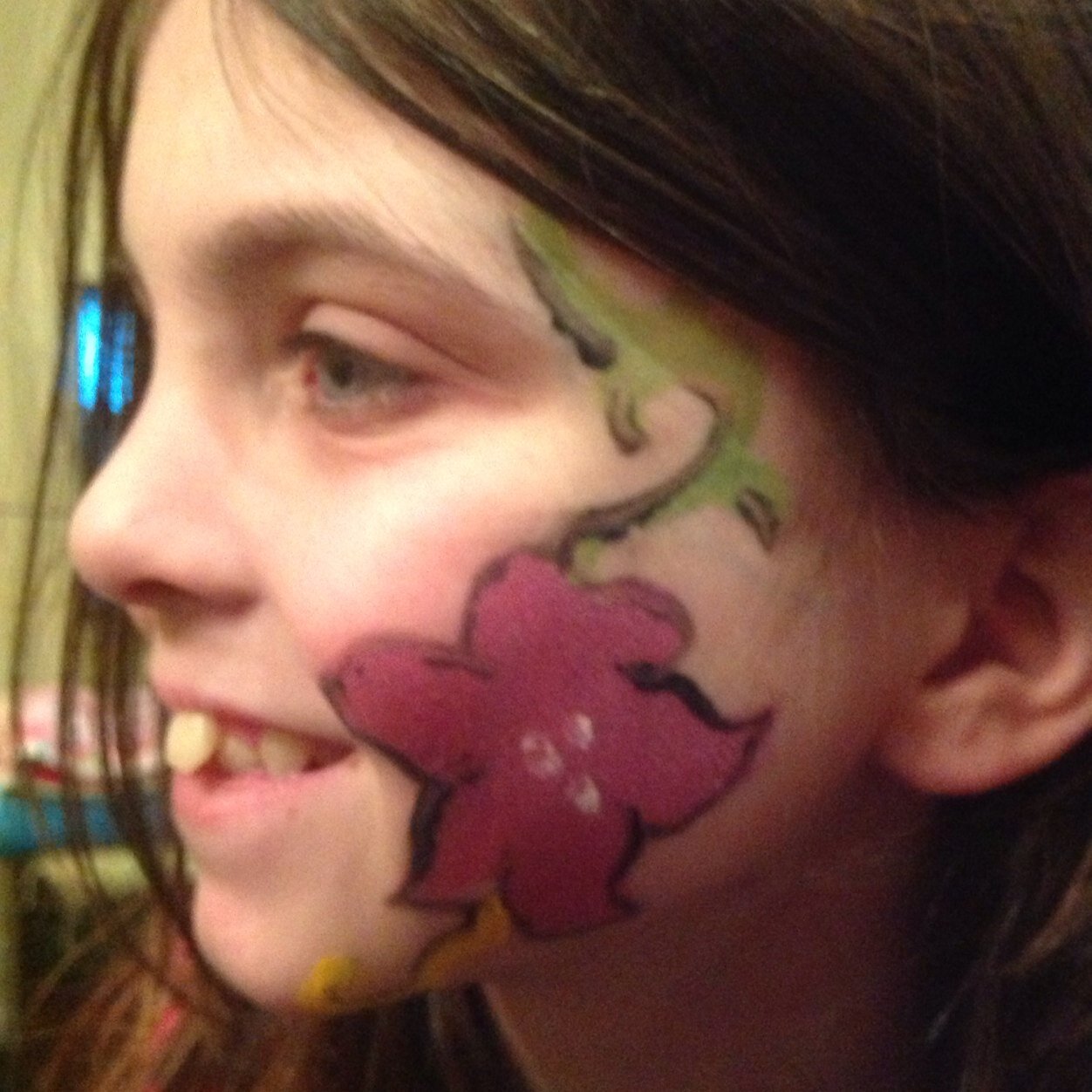 Sinead has cystic fibrosis with one mutation of G551D which is treatable with Ivacaftor (kalydeco). As her mum it is my mission in life to get her this drug