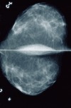 Mammography group- get latest updates about Mammogram research, news, companies and products