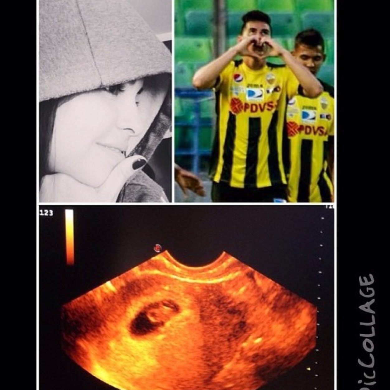 Ex Jugador del Trujillanos Fc, actualmente Jugador del Deportivo Tachira
