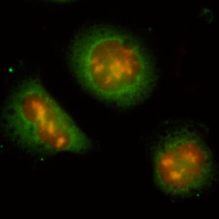 Epgntx's profile picture. Epigenetics: History, Molecules and Disease. A book by John M. Greally. Coming soon.