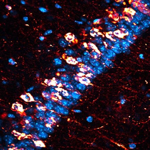 Our work at UCSB's Neuroscience Research Institute focuses on neuroplasticity, neurodegeneration, stem cell therapy, and Alzheimer's disease.