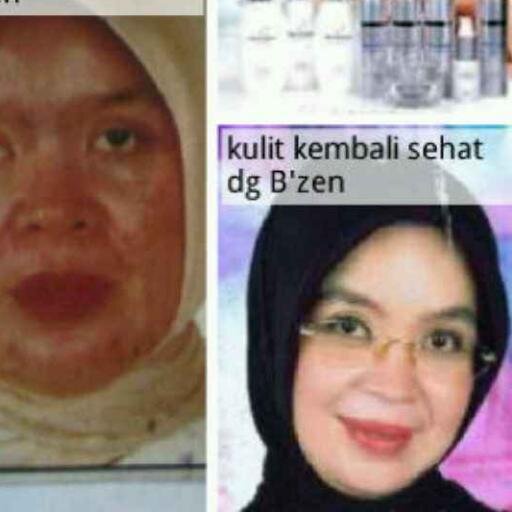 Ingin cantik alami tanpa bahan kimia | produk kecantikan alami lulus BPOM tersedia pula klinik kecantikan hub 085721989307 PIN:314054CA