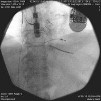 Roger Carrillo, MD (@laserlead) 's Twitter Profile