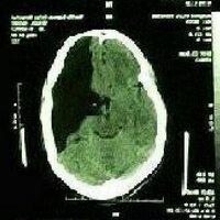 Dwight Sloan (@2thirdsbrain) 's Twitter Profile