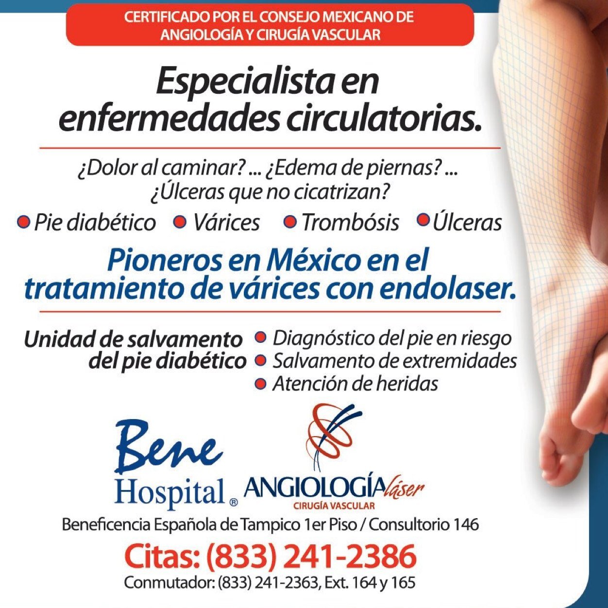 edema de pierna en diabetes