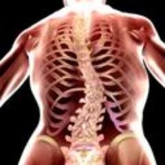 Diagnóstico de escoliose aos 15 anos de idade (2005). Hoje, aos 24 anos, resolvi parar de fugir da cirurgia. Um pouquinho do meu mundo, para meus seguidores.