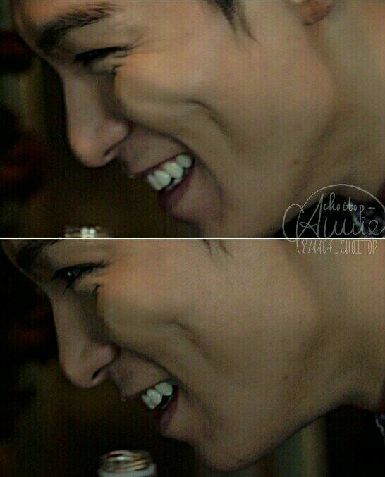 top♥